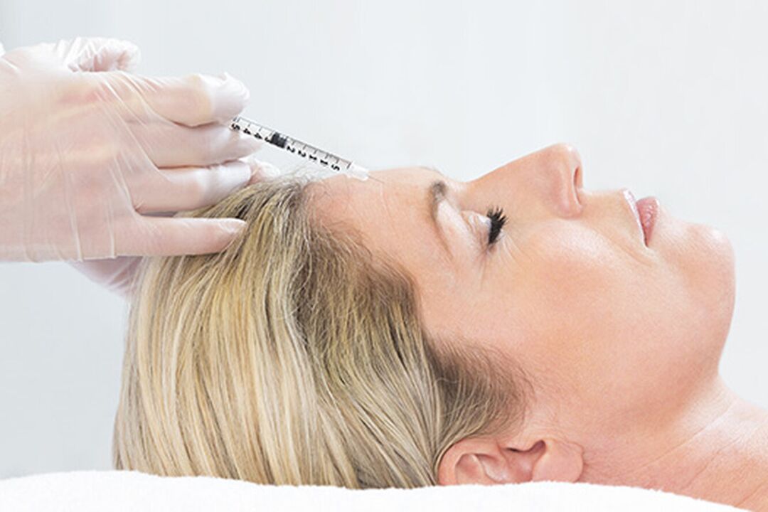 Plasmolifting, yüz derisini gençleştirmek için uygulanan bir enjeksiyon yöntemidir. 